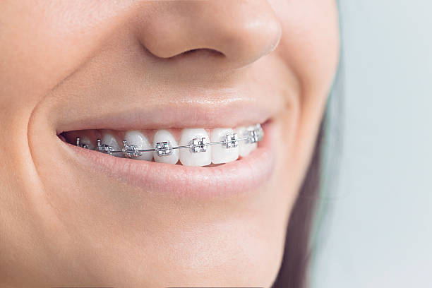 Best Full Mouth Reconstruction  in Basile, LA